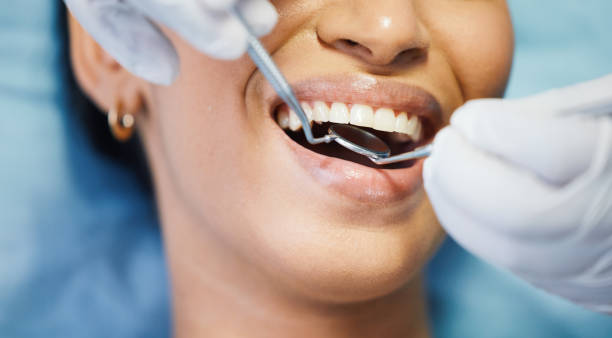 Best Urgent Care for Lost Fillings or Crowns in Shelburne Falls, MA